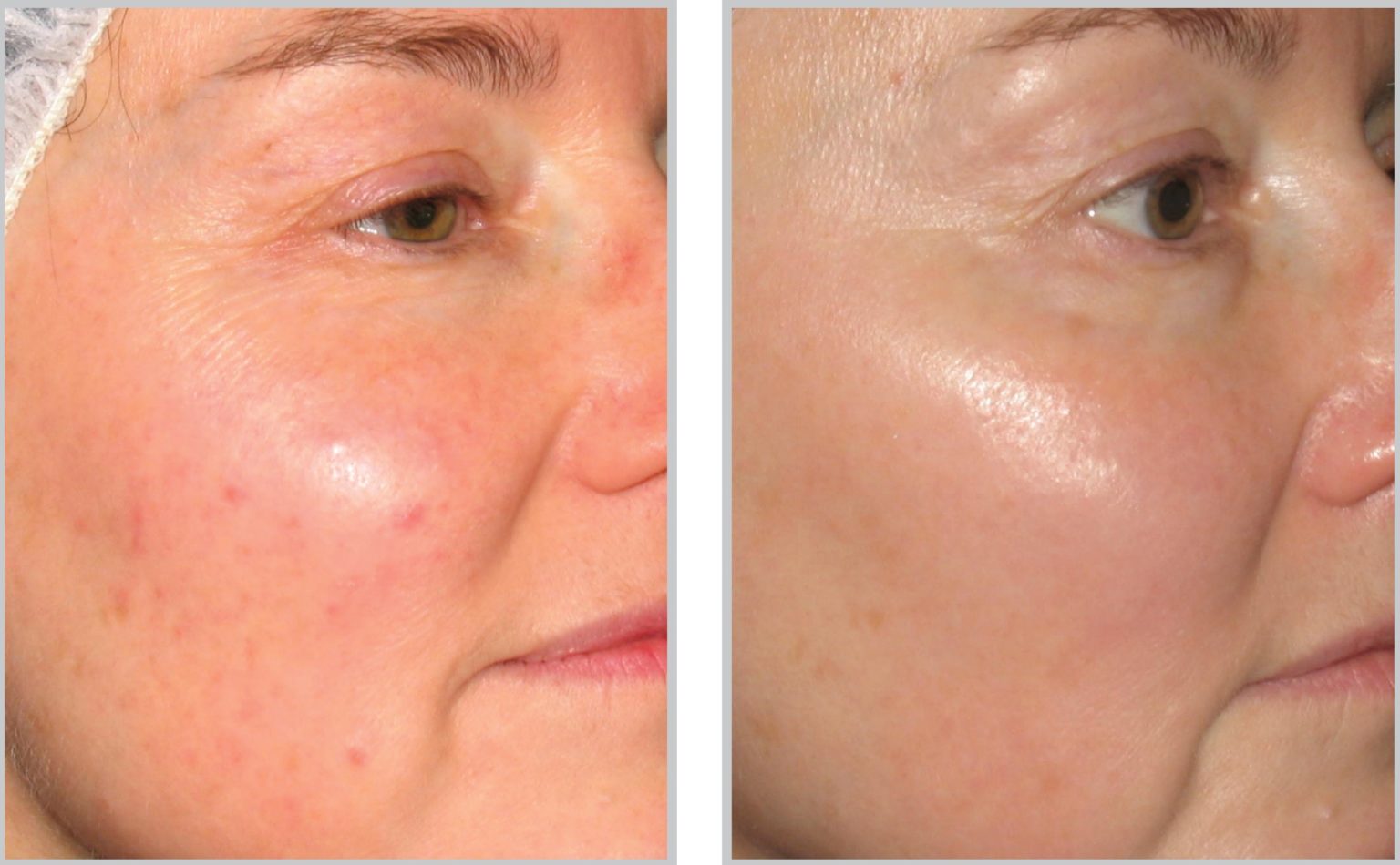 PureMD The Premier Medical Spa in Miamisburg